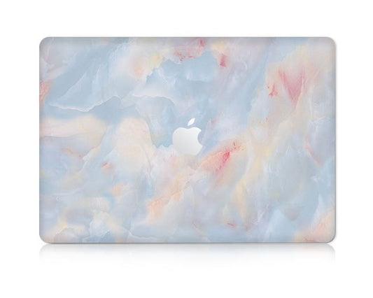 Blue Skies MacBook Case