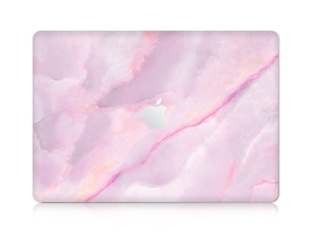 Sweet Candy MacBook Case